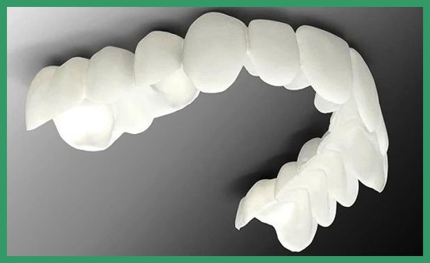 مزایای لمینت های متحرک دندان کیسا 91 چیست